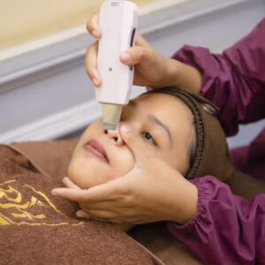 Facial Clearing Acne