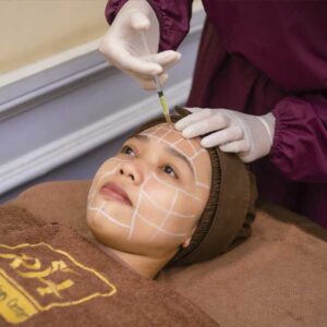 PRP (Platelet Rich Plasma)
