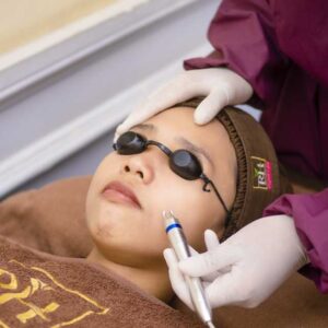 LASER DIODE VASCULAR